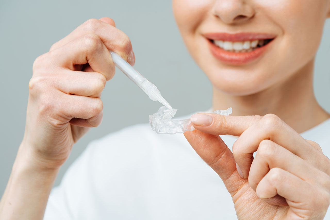 Clear Aligners, Invisalign Treatments Fanwood, NJ