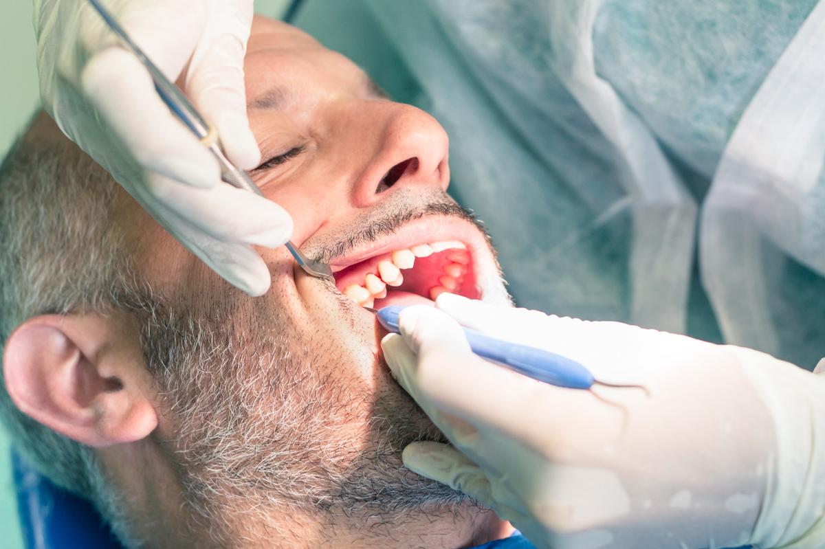 Root Canal Therapy in Fanwood, NJ: Myths, Symptoms, and What to Expect